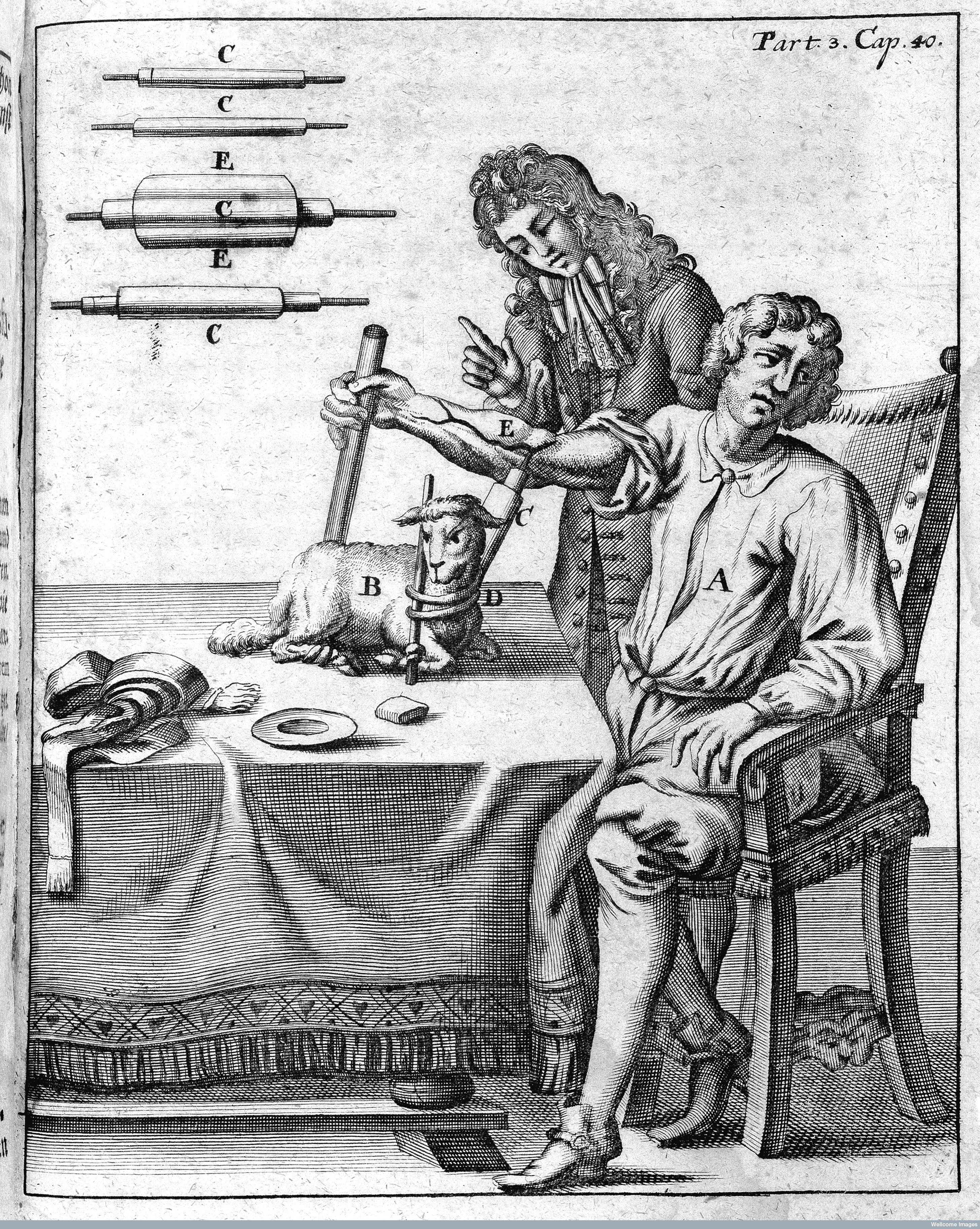 L0000096 A early blood transfusion from lamb to man Credit: Wellcome Library, London. Wellcome Images images@wellcome.ac.uk http://wellcomeimages.org A early blood transfusion from lamb to man. 1705 Grosser und gantz neugewundener Lorbeer-Krantz, oder Wund Artzney ... Zum andern Mahl vermehrt heraus gegeben / Matthias Gottfried Purmann Published: 1705. Copyrighted work available under Creative Commons Attribution only licence CC BY 4.0 http://creativecommons.org/licenses/by/4.0/
